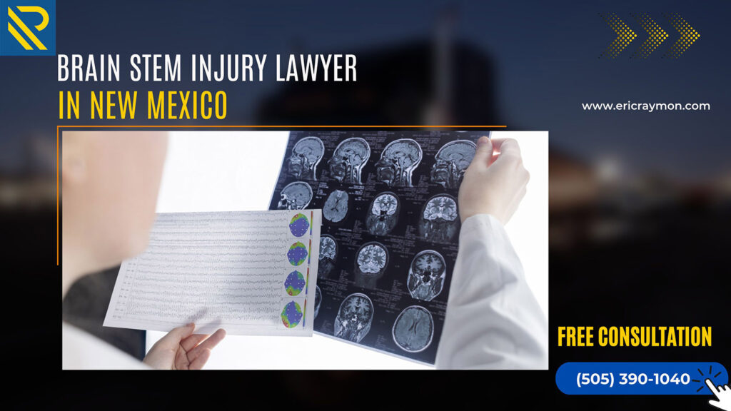 Legal Considerations for Brain Stem Injuries in New Mexico