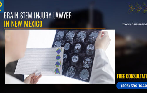 Legal Considerations for Brain Stem Injuries in New Mexico
