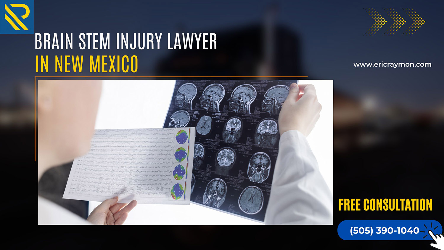 Legal Considerations for Brain Stem Injuries in New Mexico